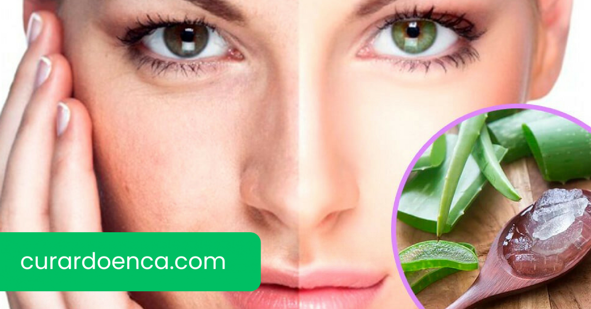 rugas (Imagem divulgação)