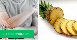 Remédios naturais incríveis para dor nas articulações