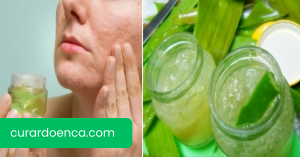 babosa (Imagem divulgação)