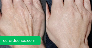 mãos (Imagem divulgação)