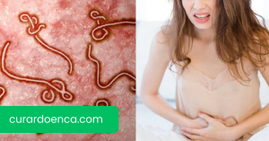 Amebíase (Imagem divulgação)