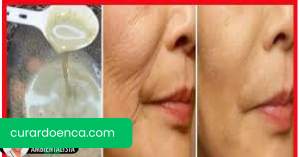 CREME NÍVEA E UM OVO PARA DESAPARECER AS RUGAS DO ROSTO E SER 10 ANOS MAIS JOVENS.