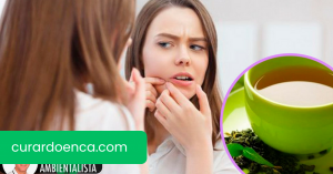 6 maneiras de usar o chá verde contra a acne