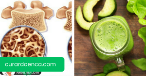 Como preparar um remédio rico em cálcio para prevenir a osteoporose