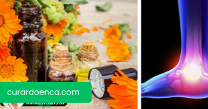 Entorse: como tratar os sintomas naturalmente