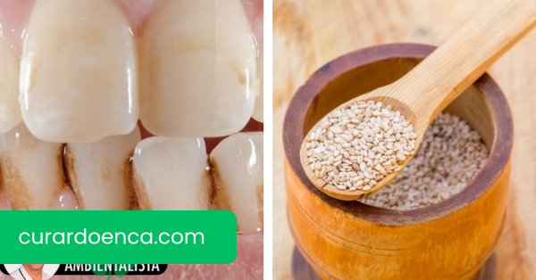 Como remover o tártaro de seus dentes naturalmente