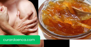 Miosite (Imagem divulgação)