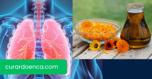 bronquiectasia (Imagem divulgação)