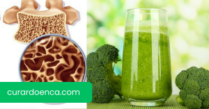 osteoporose (Imagem divulgação)