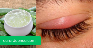 terçol (Imagem divulgação)