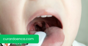 Remédio de brócolis e goiaba para tratar faringite