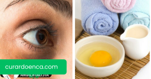 Como reduzir as olheiras: 5 métodos naturais