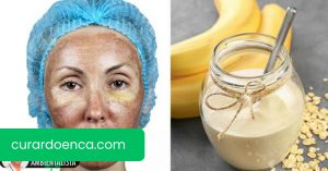 Como fazer um tratamento de iogurte, banana e limão para atenuar o melasma