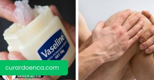 Prepare uma pomada de vaselina e casca de olmo para reumatismo