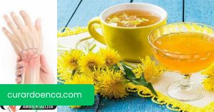 Dandelion drink: um remédio caseiro para cuidar dos seus ossos