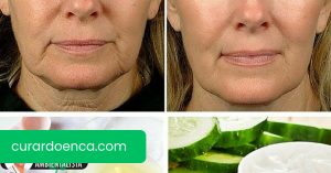 5 remédios caseiros para combater a flacidez facial