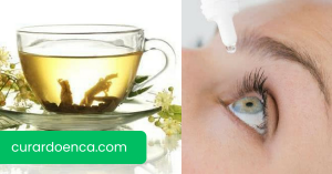 glaucoma (Imagem divulgação)