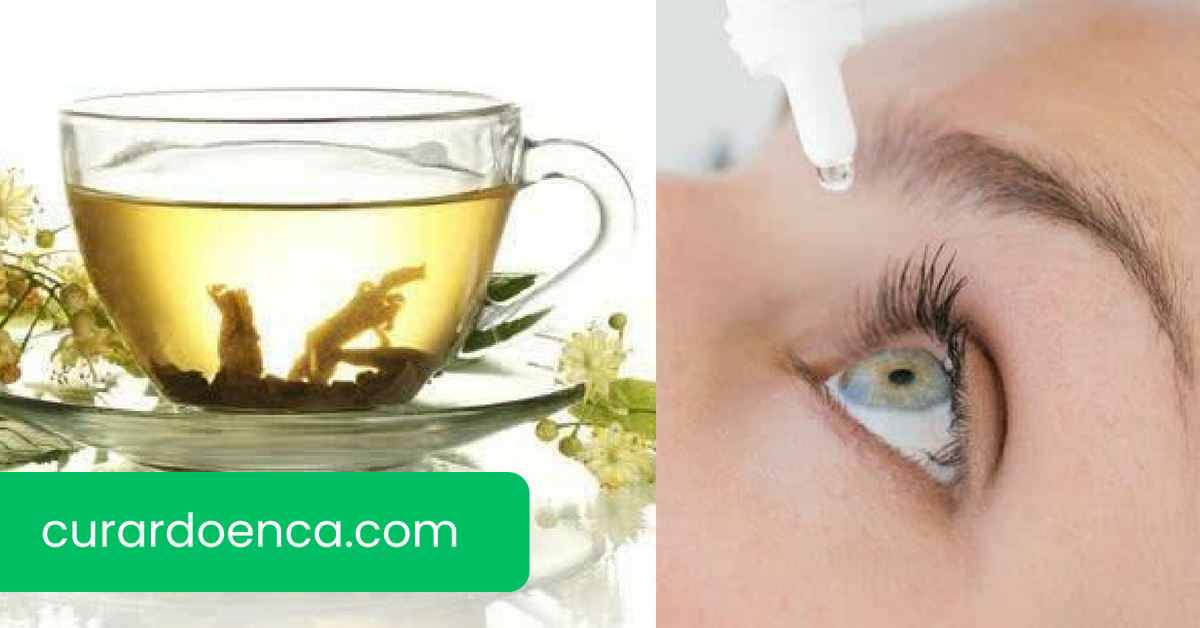 glaucoma (Imagem divulgação)