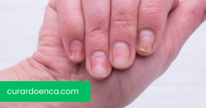 Unhas (Imagem divulgação)