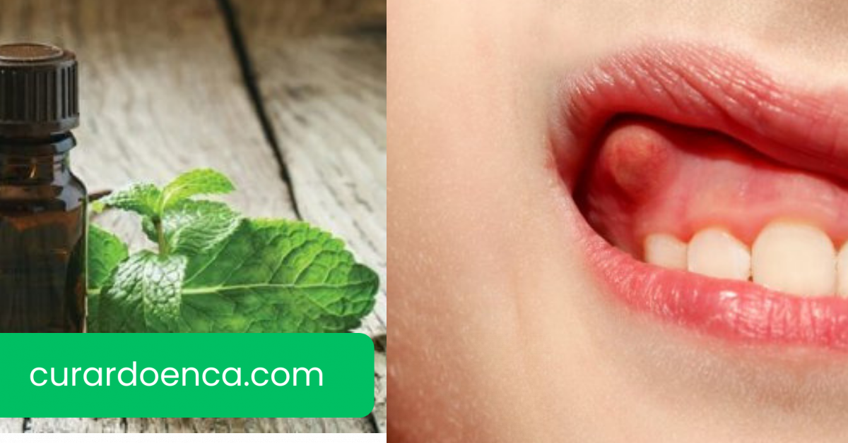 abscesso (Imagem divulgação)