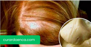 cabelo (Imagem divulgação)
