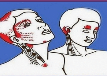 Cuidado! Esses sinais podem indicar deficiência de vitamina B12 – veja se você tem algum